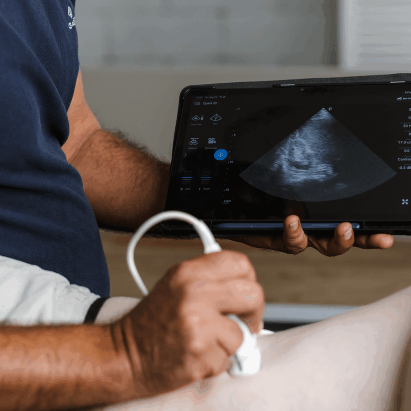 קורס POCUS בטן מתקדם