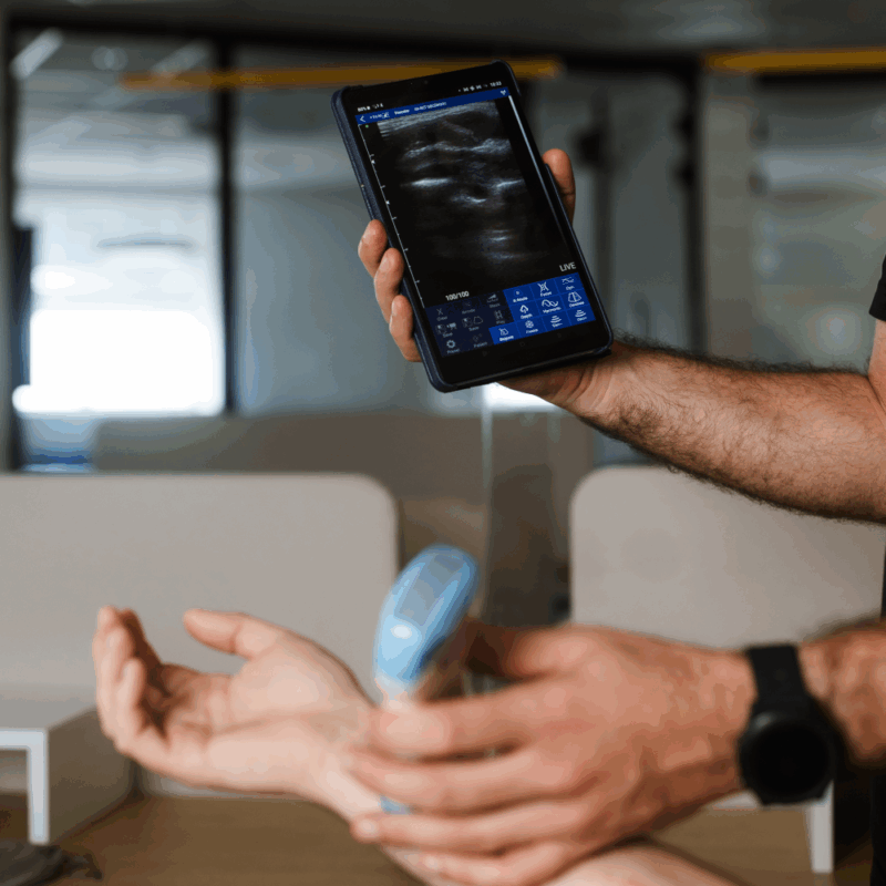 קורס POCUS להערכת רקמה רכה, שריר ושלד