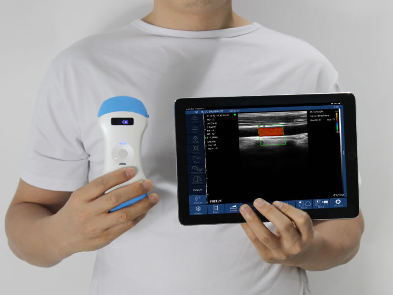 sonostar_ultrasound_scanner_with_tablet